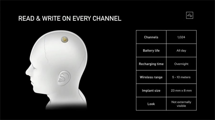 Neuronalink connetterà il cervello umano alle macchine